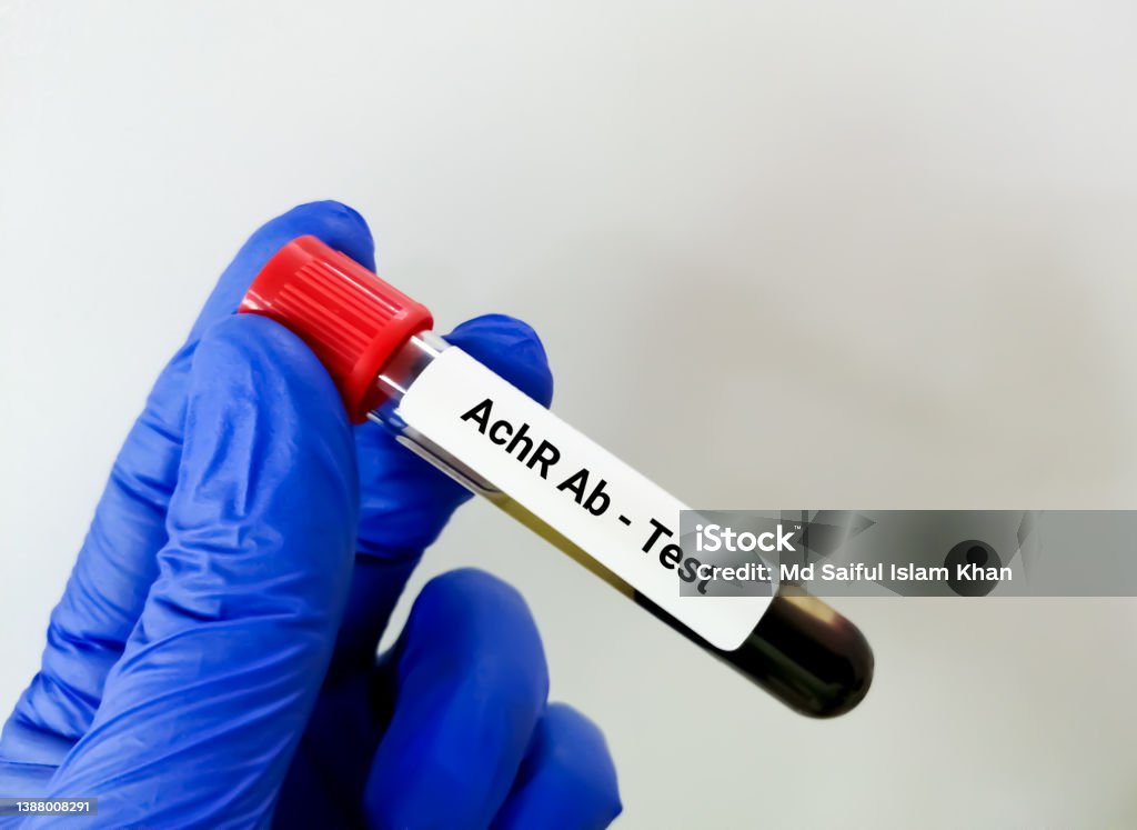 Test Tube With Blood For Achr Or Acetylcholine Receptor Antibody Test Test Tube With Blood For Achr Or Acetylcholine Receptor Antibody Test