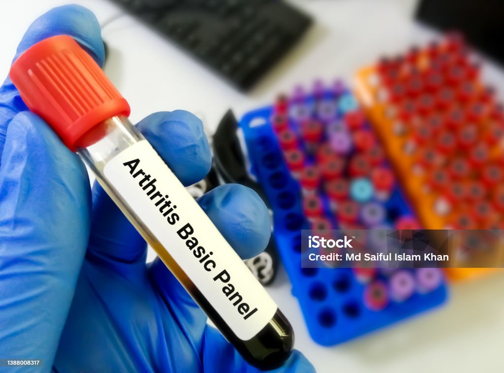Blood Sample For Arthritis Panel Test Stock Photo Download Image Now Blood Sample For Arthritis Panel Test Stock Photo Download Image Now