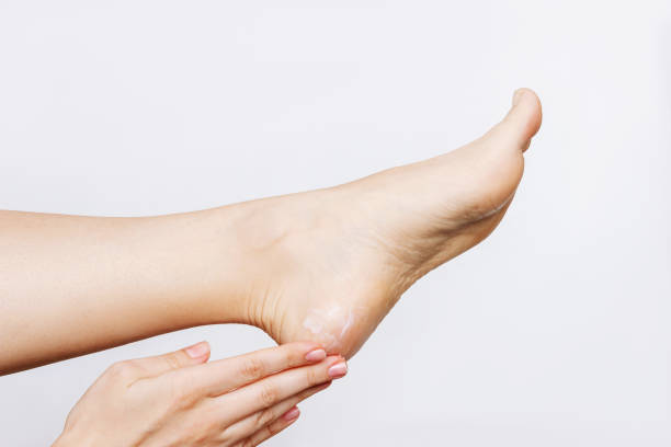피부 부드러움을위한 크림으로 발의 마른 발 뒤꿈치를 보습하는 젊은 여성의 잘린 샷 - human leg smooth human skin human foot 뉴스 사진 이미지
