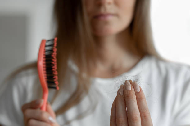 mujer perdiendo pelo en el cepillo para el pelo en la mano - cabello humano fotografías e imágenes de stock