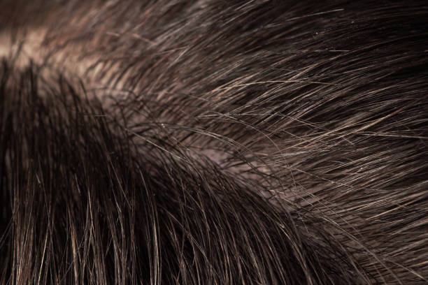 istock Super macro close up hair and scalp. 1388203842