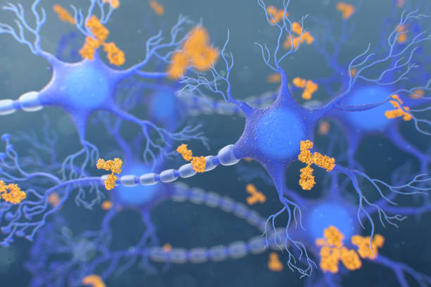 antibodies attacking a neuron. concept of autoimmune neurologic diseases - corpus striatum imagens e fotografias de stock