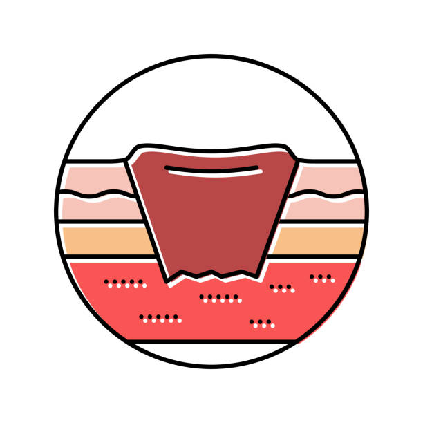 bedsore pressure ulcers disease color icon vector illustration bedsore pressure ulcers disease color icon vector. bedsore pressure ulcers disease sign. isolated symbol illustration salivary gland surgery stock illustrations