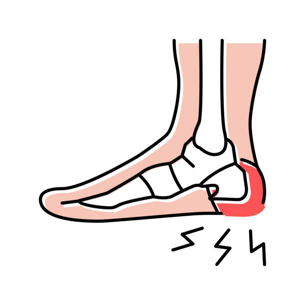 heel spur disease color icon vector illustration heel spur disease color icon vector. heel spur disease sign. isolated symbol illustration salivary gland surgery stock illustrations