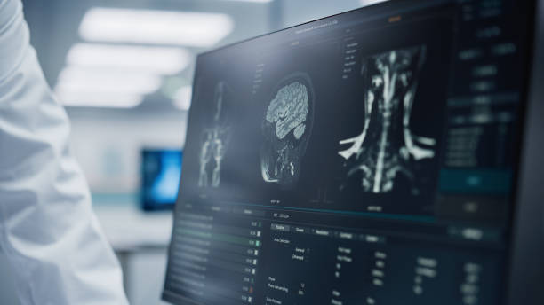 istock Medical Hospital: Neurologist and Neurosurgeon Talk, Use Computer, Analyse Patient MRI Scan, Diagnose Brain. Brain Surgery Health Clinic Lab: Two Professional Physicians Look at CT Scan. Close-up 1388387837
