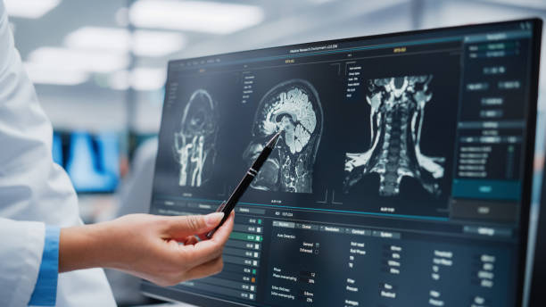 hospital médico: neurologista e neurocirurgião conversa, uso de computador, análise ressonância magnética do paciente, diagnóstico cerebral. laboratório de clínica de saúde de cirurgia cerebral: dois médicos profissionais olham para tomografia co - neuroscience - fotografias e filmes do acervo