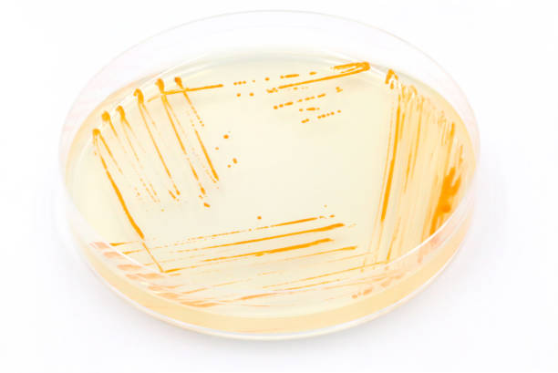 istock Microbiological culture plate with colonies of microorganisms 1388399942
