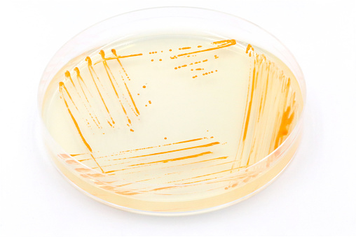 Microbiological culture plate with colonies of microorganisms