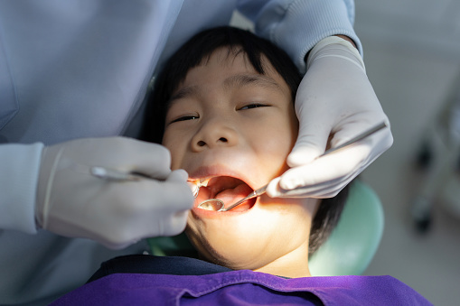 Hand of Doctor dentist is working on the teeth of asian little kid 6 year old patient in dental clinic