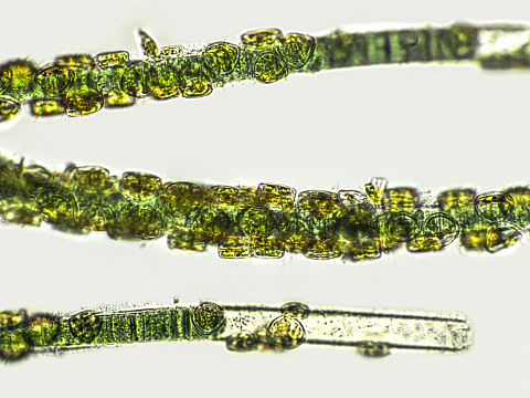 Blue green filamentous algae under microscopic view, cyanobacteria, green algae