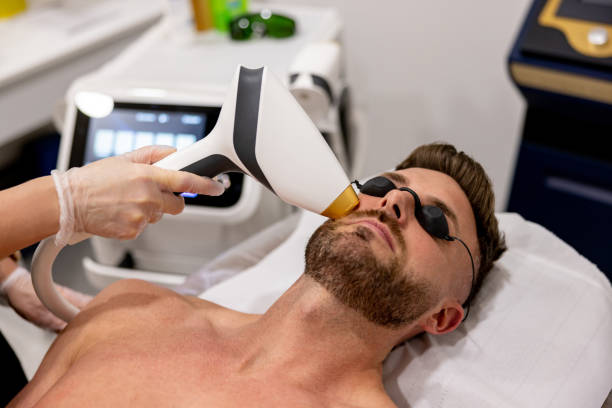 Man getting a laser hair removal on his face