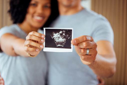 Woman and her boyfriend holding up an image of her sonogram of the baby. Young happy Couple with baby ultrasound