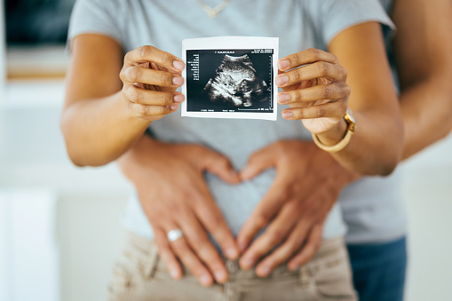 Woman and her boyfriend holding up an image of her sonogram of the baby. Young happy Couple with baby ultrasound