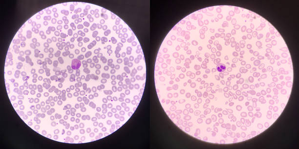 istock Left Eosinophil and right Neutrophil white blood cells 1388918884