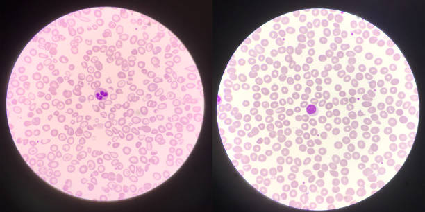istock Left Neutrophil and right lymphocyte white blood cells. 1388918899
