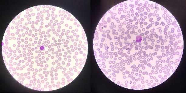 istock Left Lymphocyte and right Eosinophil white blood cells 1388919056