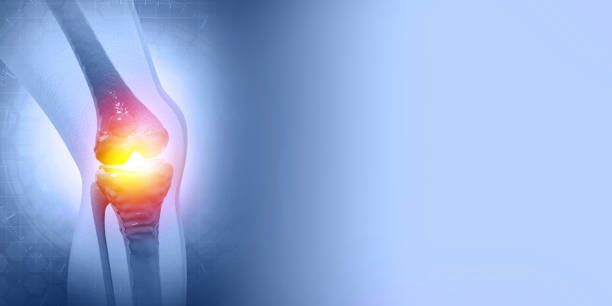istock Pain in knee joint. Tendon problems and Joint inflammation on dark background 1388931116