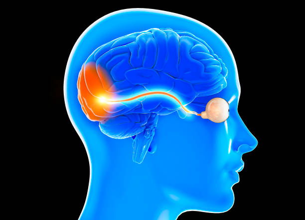 nervo ottico, sezione del cervello vista di lato. lesioni nervose. scarsa vista. neurite ottica. infiammazione - lente bulbo oculare foto e immagini stock