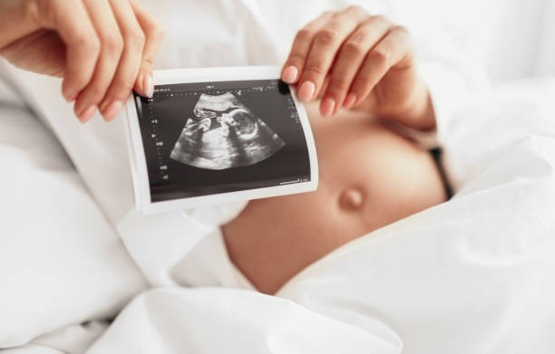 istock Crop pregnant woman showing sonogram 1389206436