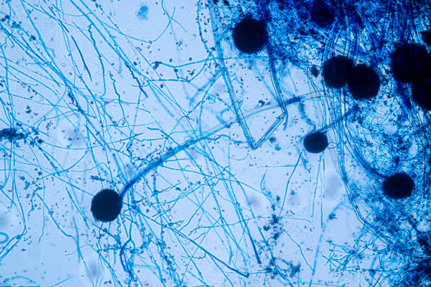 istock Aspergillus niger and Aspergillus oryzae  (mold) under microscope for Microbiology in Lab. 1389240126