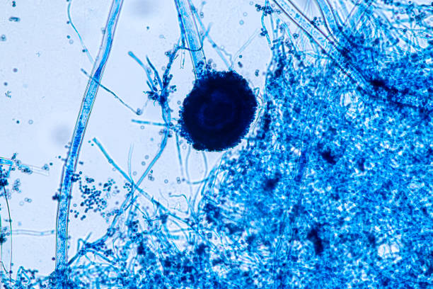 istock Aspergillus niger and Aspergillus oryzae  (mold) under microscope for Microbiology in Lab. 1389240145
