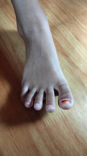 istock Kid dirty leg on the floor 1389264157