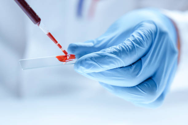 Close - up of a hand in a blue protective glove making blood test, placing a drop of blood on a microscope Slide for a microscopy stock photo
