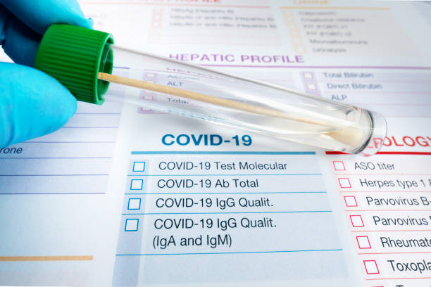 doctor holding tube with nasal swab and requisition form for analysis of Covid-19 or coronavirus test patient nasal fluid sample tube for covid molecular test. doctor holding tube with nasal swab and requisition form for analysis of Covid-19 or coronavirus test sars cov 2 delta variant stock pictures, royalty-free photos & images