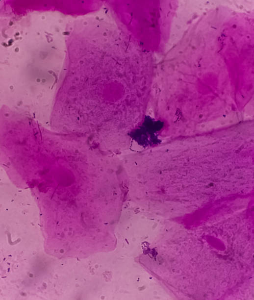 istock Gram stain: Epithelial cells, Gram negative rod, Gram positive cocci, 40x microscopic view 1389450619