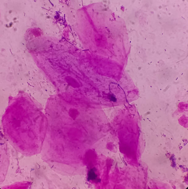istock Gram stain: Epithelial cells, Gram negative rod, Gram positive cocci, 40x microscopic view 1389450631