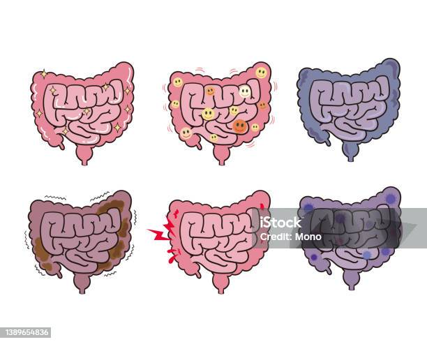 Inglustination Intestinal Various Intestinal Condition Set Illustrations Stock Illustration ...