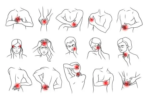 Vector illustration of Human body pain. Neck muscle head and joints painful symptoms. People line figures with ache localization. Discomfort in knees and elbows Headache and backache. Vector injuries set