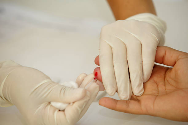 patient blood collection salvador, bahia, brazil - july 28, 2017: blood is collected from a patient to perform rapid tests for the diagnosis of Hepatitis B and C in the city of Salvador. hyperglycemia stock pictures, royalty-free photos & images