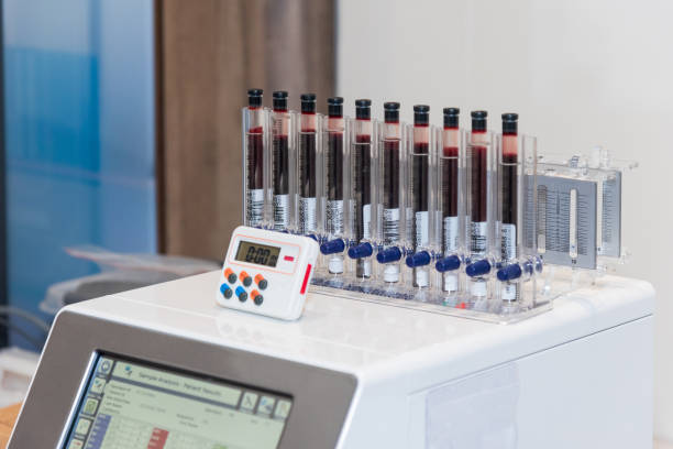 tray with blood tube samples in hospital or clinic - bloedbank stockfoto's en -beelden