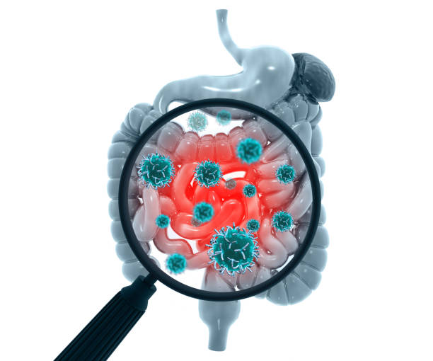 istock Human digestive system infected by virus and bacteria. Digestive tract or alimentary cana. 3d illustration 1389882053