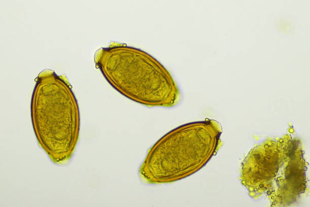 istock Trichuris trichiura (whipworm) in stool 1389890426