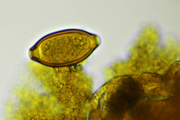 istock Trichuris trichiura (whipworm) in stool 1389890427