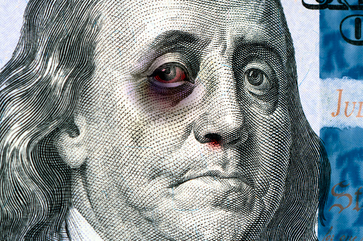 Benjamin Franklin on a 100 us bill with a black eye. The concept of the economic crisis in the United States. Inflation dollar. Refusal of international dollar settlements