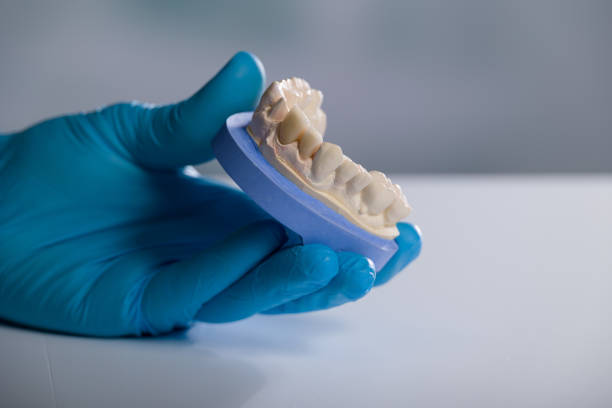 istock Dentist's / dental technician's hand in gloves are presenting a dental imprint with artificial dentition ready for use 1390037551