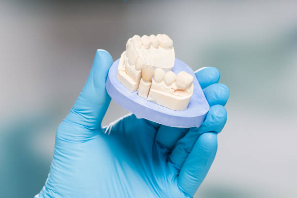 istock Dentist's / dental technician's hand in gloves are presenting a dental imprint with artificial dentition ready for use 1390037588