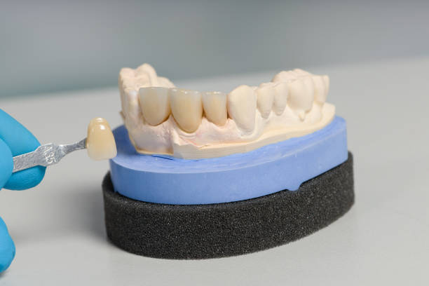 istock checking veneer of new dentition on a dentist's workbench 1390037589