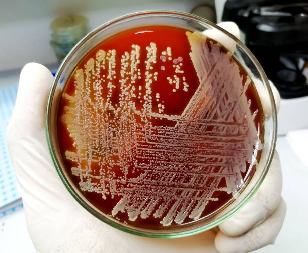 Staph aureus: Gram positive bacteria. Staphylococcus or streptococcus growth on blood agar. closeup. stock photo