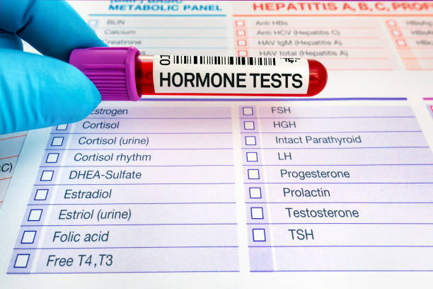 호르몬 검사의 수준 연구를위한 혈액 샘플 - uneven 뉴스 사진 이미지