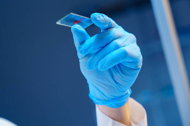 istock A microscope slide with a blood sample in a hand of a scientist from the low angle 1390303214