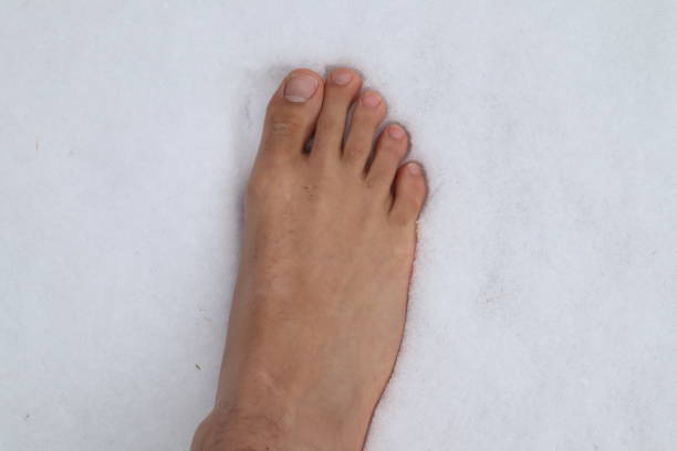 istock Foot with second toe longer than big toe, which is known as Morton's toe. 1390509438