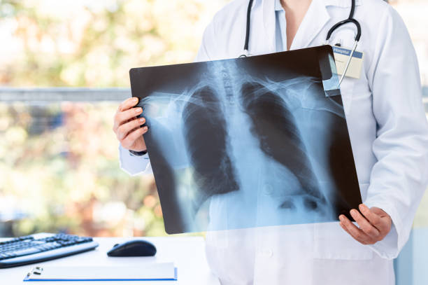 female doctor diagnosing patient's health Doctor diagnosing patient's health on asthma, lung disease, long COVID-19, coronavirus or bone cancer illness with radiological chest x-ray film for medical healthcare hospital service long covid stock pictures, royalty-free photos & images