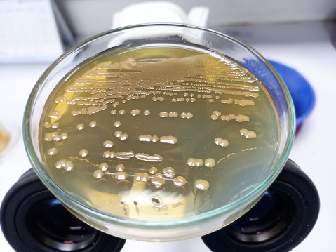 Bacteria culture growth on hichrome uti agar media plate in microbiology laboratory, Proteus colonies. Bacteria culture growth on a petri dish. Gram negative bacteria colonies