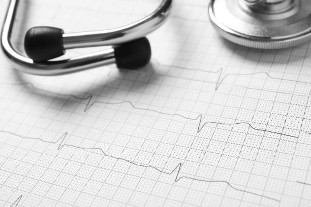 istock Stethoscope on cardiogram report, closeup. Heart diagnosis 1390817058