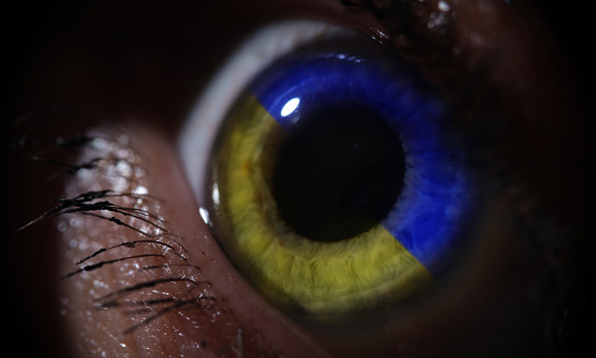 Female eye in blue and yellow iris color of Ukraine flag closeup. Assistance to Ukrainian refugees concept
