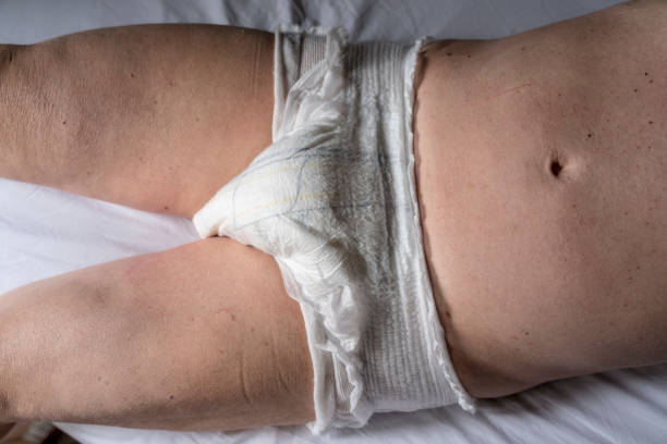 istock Man wearing incontinence diaper 1390845901
